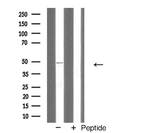 Polyclonal Rabbit anti-Human BMP4 Antibody (WB)
