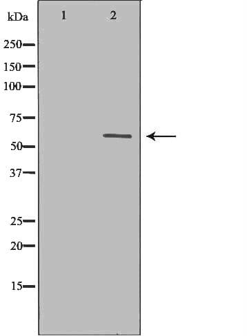 Polyclonal Rabbit anti-Human CASP10 / Caspase 10 Antibody (IHC, WB)