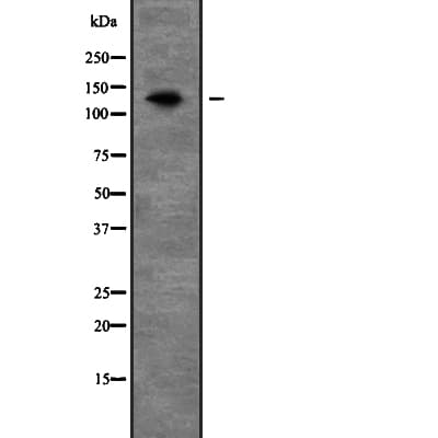 Polyclonal Rabbit anti-Human PEX1 Antibody (WB)