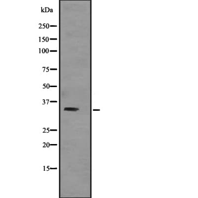 Polyclonal Rabbit anti-Human TNNT3 Antibody (IHC, WB)