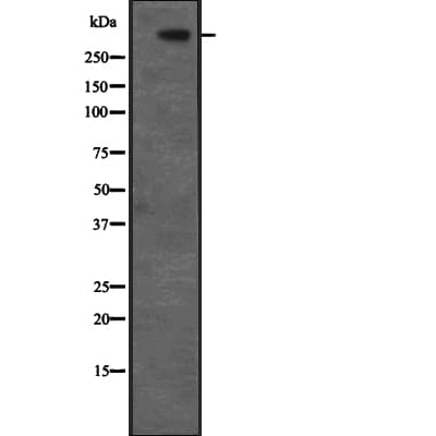 Polyclonal Rabbit anti-Human CENPF / CENP-F Antibody (IHC, WB)