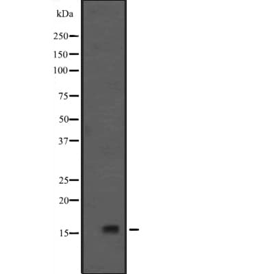 Polyclonal Rabbit anti-Human CR6 / GADD45G Antibody (WB)