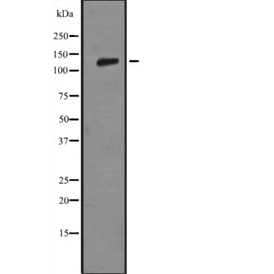 Polyclonal Rabbit anti-Human LAMB3 / Laminin Beta 3 Antibody (WB)