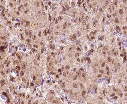 Polyclonal Rabbit anti-Human MAGEA1 / MAGE 1 Antibody (IHC, IF, WB)