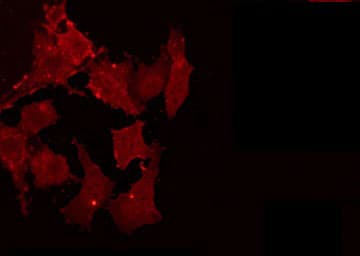 Polyclonal Rabbit anti-Human ILKAP Antibody (IHC, IF, WB)