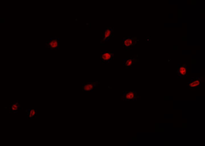 Polyclonal Rabbit anti-Human PRKDC / DNA-PKcs Antibody (IHC, IF, WB)