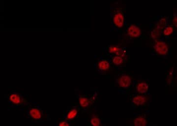 Polyclonal Rabbit anti-Human ZNF337 Antibody (IF, WB)