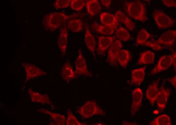 Polyclonal Rabbit anti-Human MAGEA1 / MAGE 1 Antibody (IHC, IF, WB)