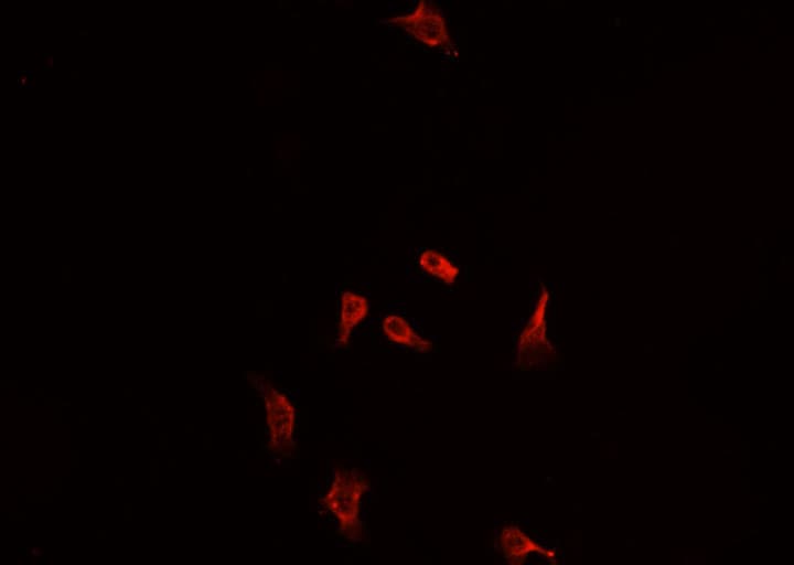 Polyclonal Rabbit anti-Human NFE2L2 / NRF2 Antibody (IHC, IF, WB)