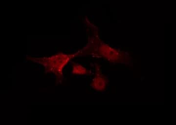 Polyclonal Rabbit anti-Human NFE2L2 / NRF2 Antibody (IHC, IF, WB)