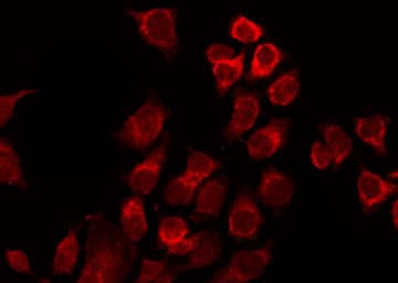 Polyclonal Rabbit anti-Human ATF2 Antibody (phospho-Ser62,phospho-Ser44, IHC, IF, WB)