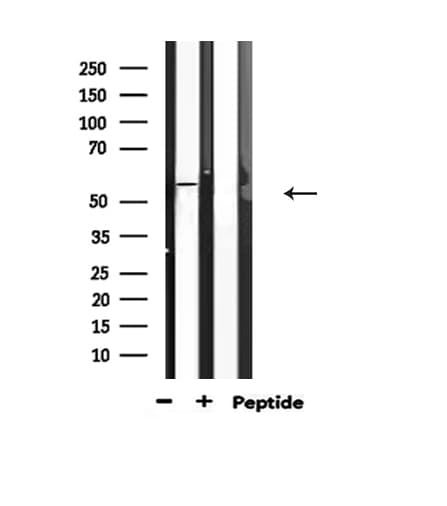 Polyclonal Rabbit anti-Human ATF2 Antibody (phospho-Ser62,phospho-Ser44, IHC, IF, WB)