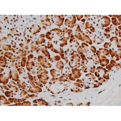 Polyclonal Rabbit anti-Human ATF2 Antibody (phospho-Thr69,phospho-Thr51, IHC, IF, WB)