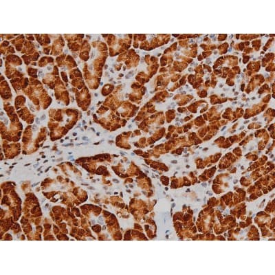 Polyclonal Rabbit anti-Human ATF2 Antibody (phospho-Thr69,phospho-Thr51, IHC, IF, WB)