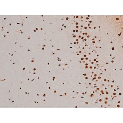 Polyclonal Rabbit anti-Human ATF2 Antibody (phospho-Thr69,phospho-Thr51, IHC, IF, WB)