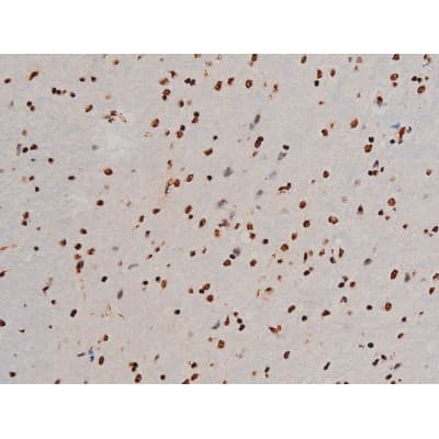 Polyclonal Rabbit anti-Human ATF2 Antibody (phospho-Thr69,phospho-Thr51, IHC, IF, WB)