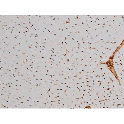 Polyclonal Rabbit anti-Human ATF2 Antibody (phospho-Thr69,phospho-Thr51, IHC, IF, WB)