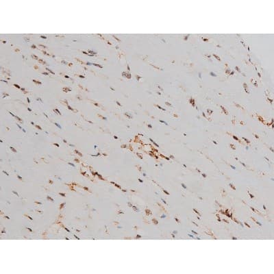 Polyclonal Rabbit anti-Human ATF2 Antibody (phospho-Thr69,phospho-Thr51, IHC, IF, WB)