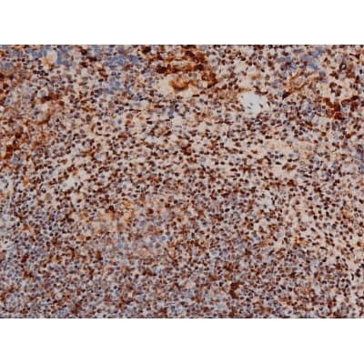 Polyclonal Rabbit anti-Human ATF2 Antibody (phospho-Thr69,phospho-Thr51, IHC, IF, WB)