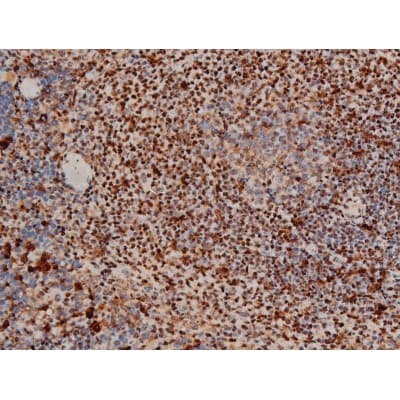 Polyclonal Rabbit anti-Human ATF2 Antibody (phospho-Thr69,phospho-Thr51, IHC, IF, WB)