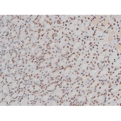 Polyclonal Rabbit anti-Human ATF2 Antibody (phospho-Thr69,phospho-Thr51, IHC, IF, WB)