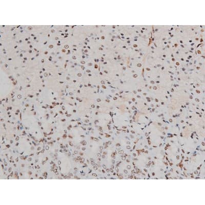 Polyclonal Rabbit anti-Human ATF2 Antibody (phospho-Thr69,phospho-Thr51, IHC, IF, WB)