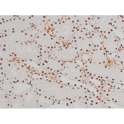 Polyclonal Rabbit anti-Human ATF2 Antibody (phospho-Thr69,phospho-Thr51, IHC, IF, WB)