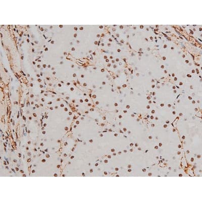 Polyclonal Rabbit anti-Human ATF2 Antibody (phospho-Thr69,phospho-Thr51, IHC, IF, WB)