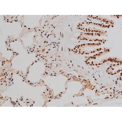 Polyclonal Rabbit anti-Human ATF2 Antibody (phospho-Thr69,phospho-Thr51, IHC, IF, WB)