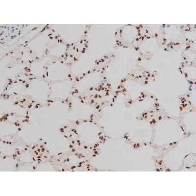 Polyclonal Rabbit anti-Human ATF2 Antibody (phospho-Thr69,phospho-Thr51, IHC, IF, WB)