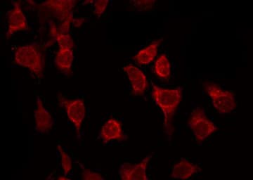 Polyclonal Rabbit anti-Human ATF2 Antibody (phospho-Thr69,phospho-Thr51, IHC, IF, WB)