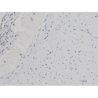 ATF2 Antibody (phospho-Thr71,pThr53)