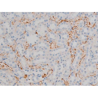 ATF2 Antibody (phospho-Thr71,pThr53)