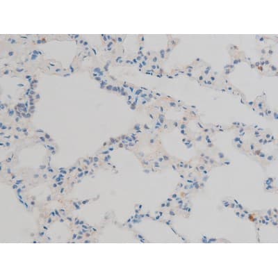 ATF2 Antibody (phospho-Thr71,pThr53)