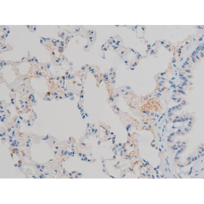 ATF2 Antibody (phospho-Thr71,pThr53)