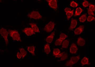 ATF2 Antibody (phospho-Thr71,pThr53)