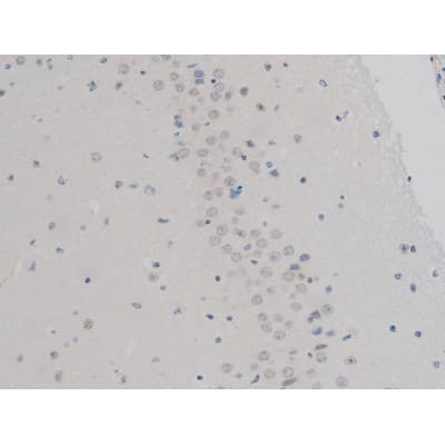 Polyclonal Rabbit anti-Human H2AFX / H2AX Antibody (phospho-Ser139, IHC, WB)
