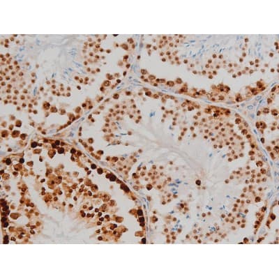 Polyclonal Rabbit anti-Human H2AFX / H2AX Antibody (phospho-Ser139, IHC, WB)