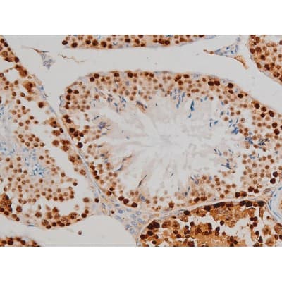 Polyclonal Rabbit anti-Human H2AFX / H2AX Antibody (phospho-Ser139, IHC, WB)