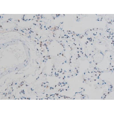 Polyclonal Rabbit anti-Human H2AFX / H2AX Antibody (phospho-Ser139, IHC, WB)
