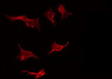 Polyclonal Rabbit anti-Human STMN1 / Stathmin / LAG Antibody (phospho-Ser24, IHC, IF, WB)