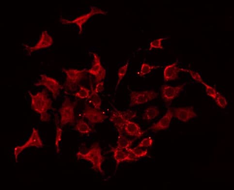 Polyclonal Rabbit anti-Human STMN1 / Stathmin / LAG Antibody (phospho-Ser37, IHC, IF, WB)