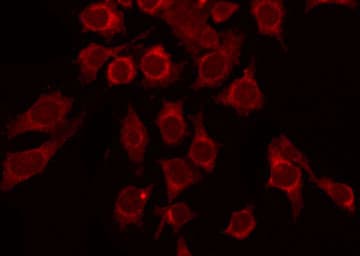 Polyclonal Rabbit anti-Human GABRB1 Antibody (phospho-Ser434, IHC, IF, WB)