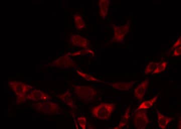 Polyclonal Rabbit anti-Human SYT1 / Synaptotagmin Antibody (phospho-Thr202, IHC, IF, WB)