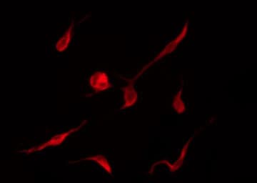 Polyclonal Rabbit anti-Human CCND3 / Cyclin D3 Antibody (phospho-Thr283, IHC, IF, WB)