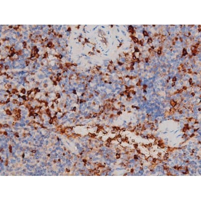CDC25A Antibody (phospho-Thr507)