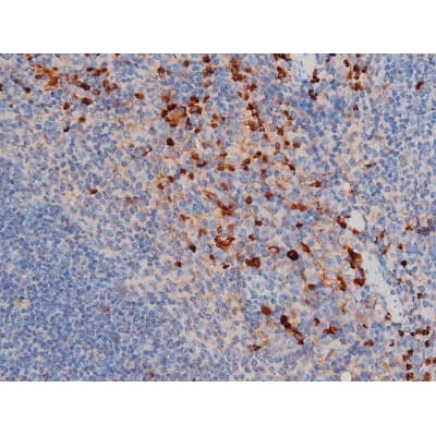 CDC25A Antibody (phospho-Thr507)