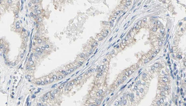 Polyclonal Rabbit anti-Human CDC25B Antibody (phospho-Ser353, IHC, IF, WB)