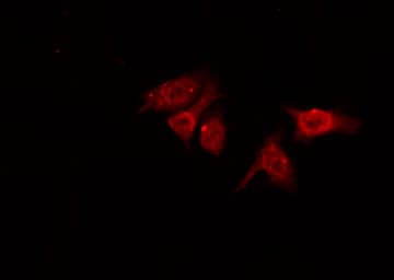 Polyclonal Rabbit anti-Human CDC25B Antibody (phospho-Ser353, IHC, IF, WB)