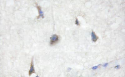 Polyclonal Rabbit anti-Human CDC25B Antibody (phospho-Ser353, IHC, IF, WB)